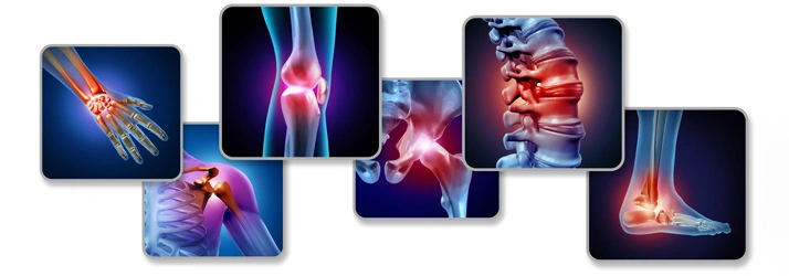 Collage of medical illustrations highlighting the hand, shoulder, knee, hip, spine, and ankle joints.
